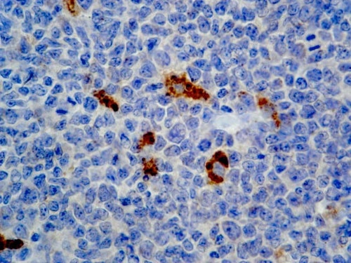 IHC of Alpha-1-Antichymotrypsin on a FFPE Tonsil Tissue
